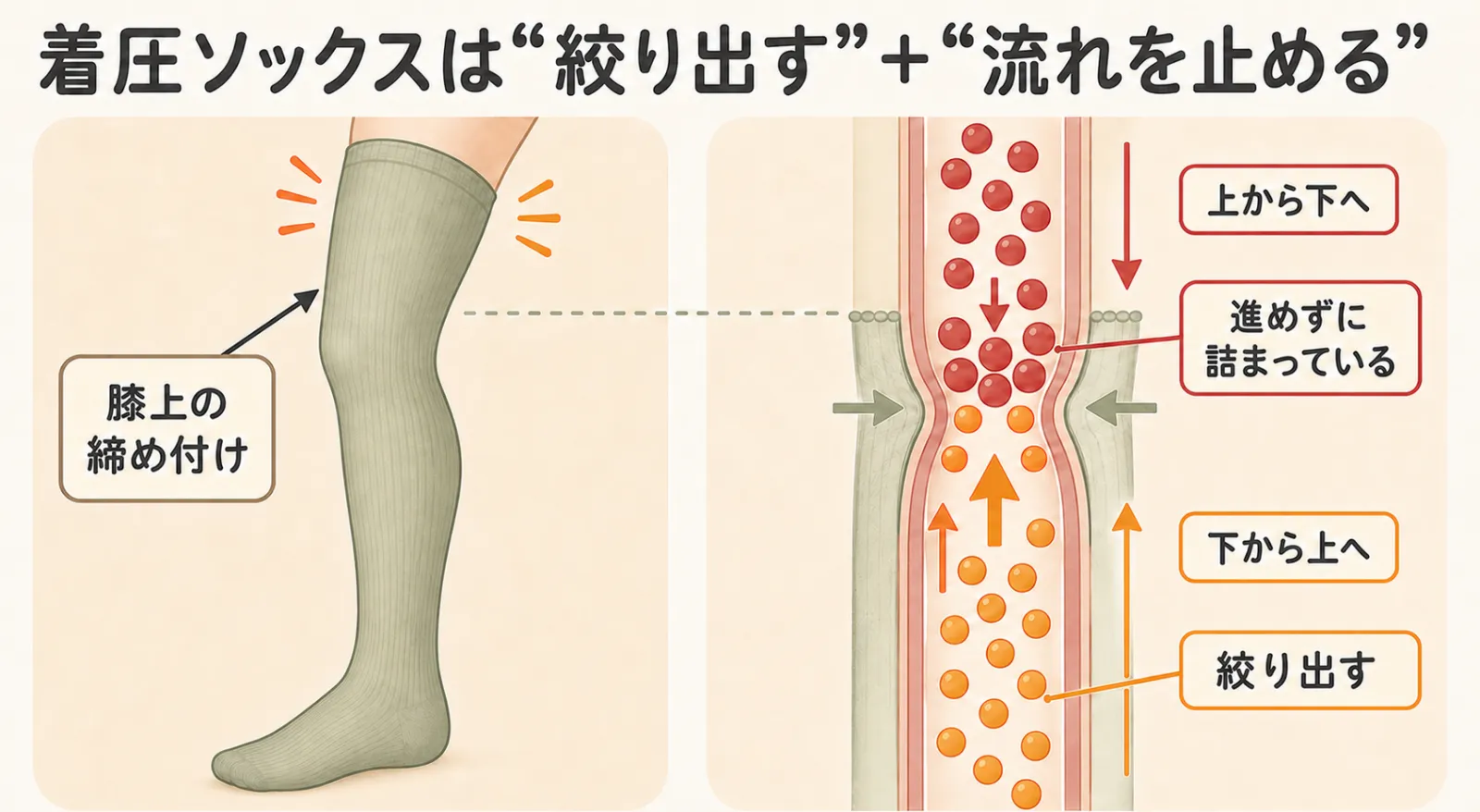 着圧ソックスが余分な水分を絞り出す働きと血流を止める働きを併せ持つことを示す図解