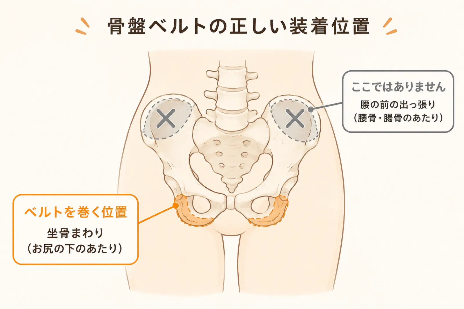 骨盤ベルトを巻く正しい位置（坐骨まわり）